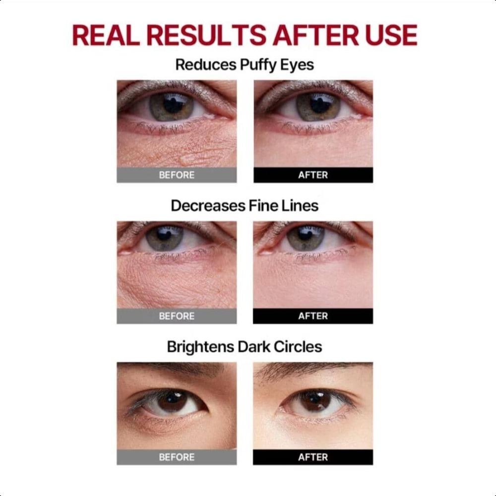 MEDITHERAPY Wrinkle Fit Tangle Eye Patch 3g 2ea x 4pcs