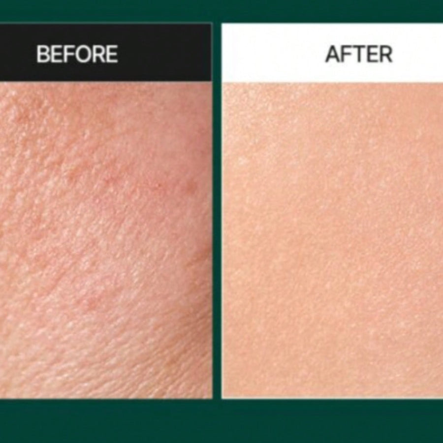 MEDIPEEL Phyto Cica-Nol B5 Leedle Shot Serum 3000