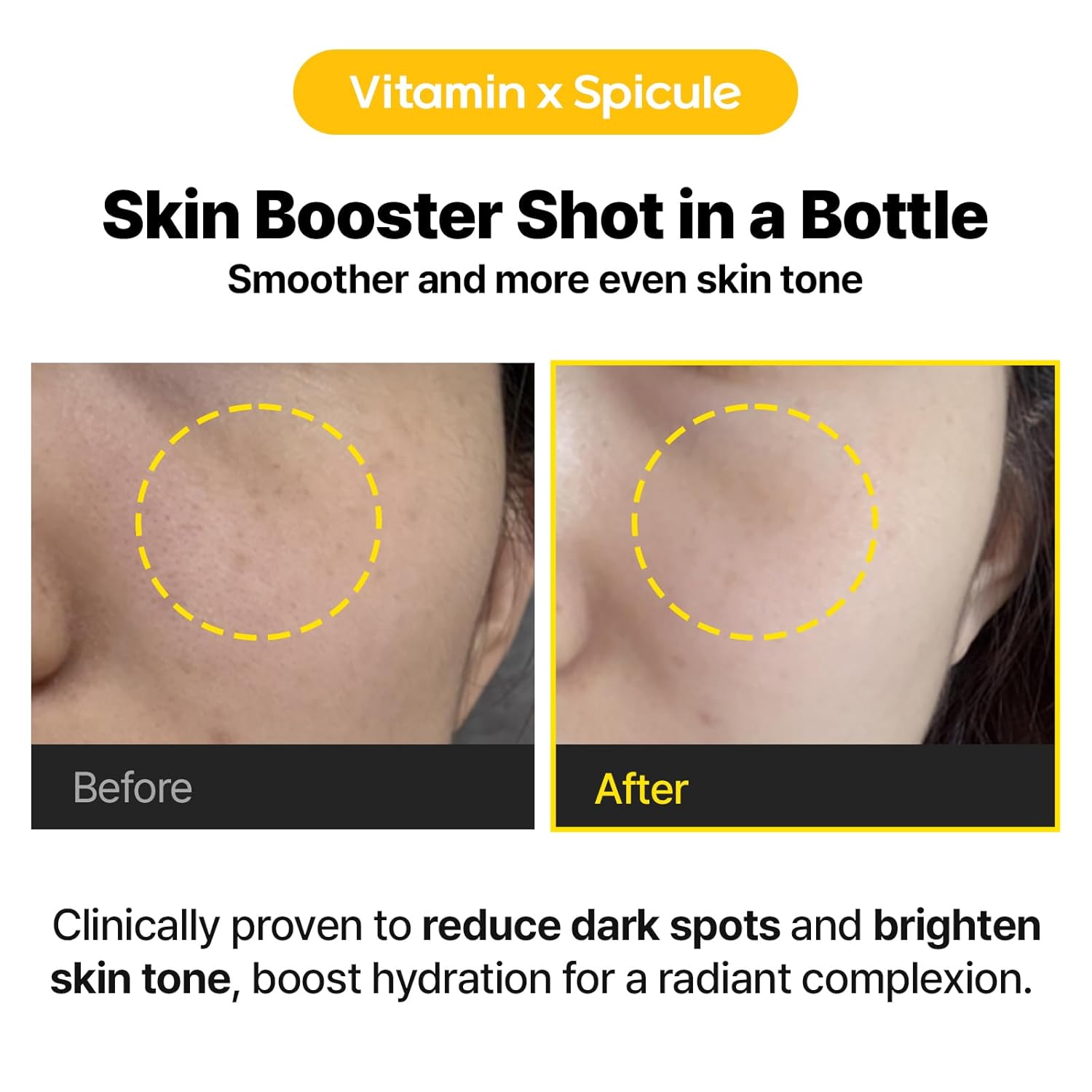 Cell Fusion C Toning C Vita Shot Ampoule, 15% Vitamin C + Spicule 300 Shot, Skin Booster Serum for Face, Exfoliation & Dark Spots, 20g / 0.7 oz.