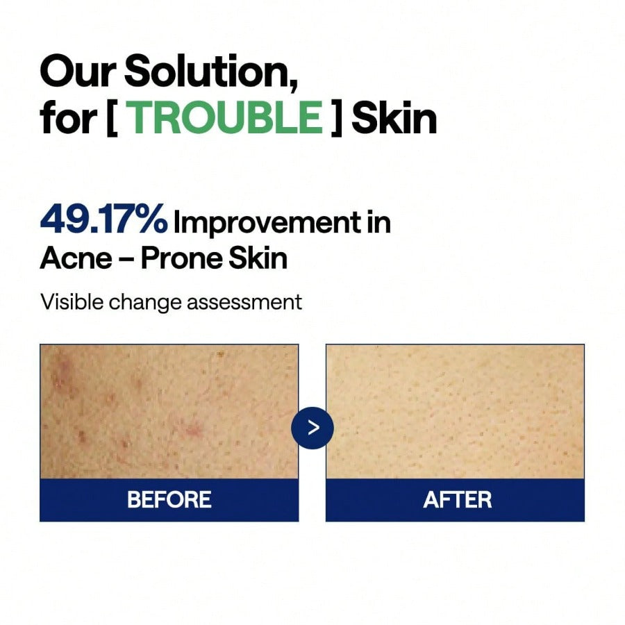 MEDIHEAL Madecassoside Toner Pads - With Centella Asiatica To Treat Blemishes And Improve Uneven Skin Tone - Vegan Gauze Fabric