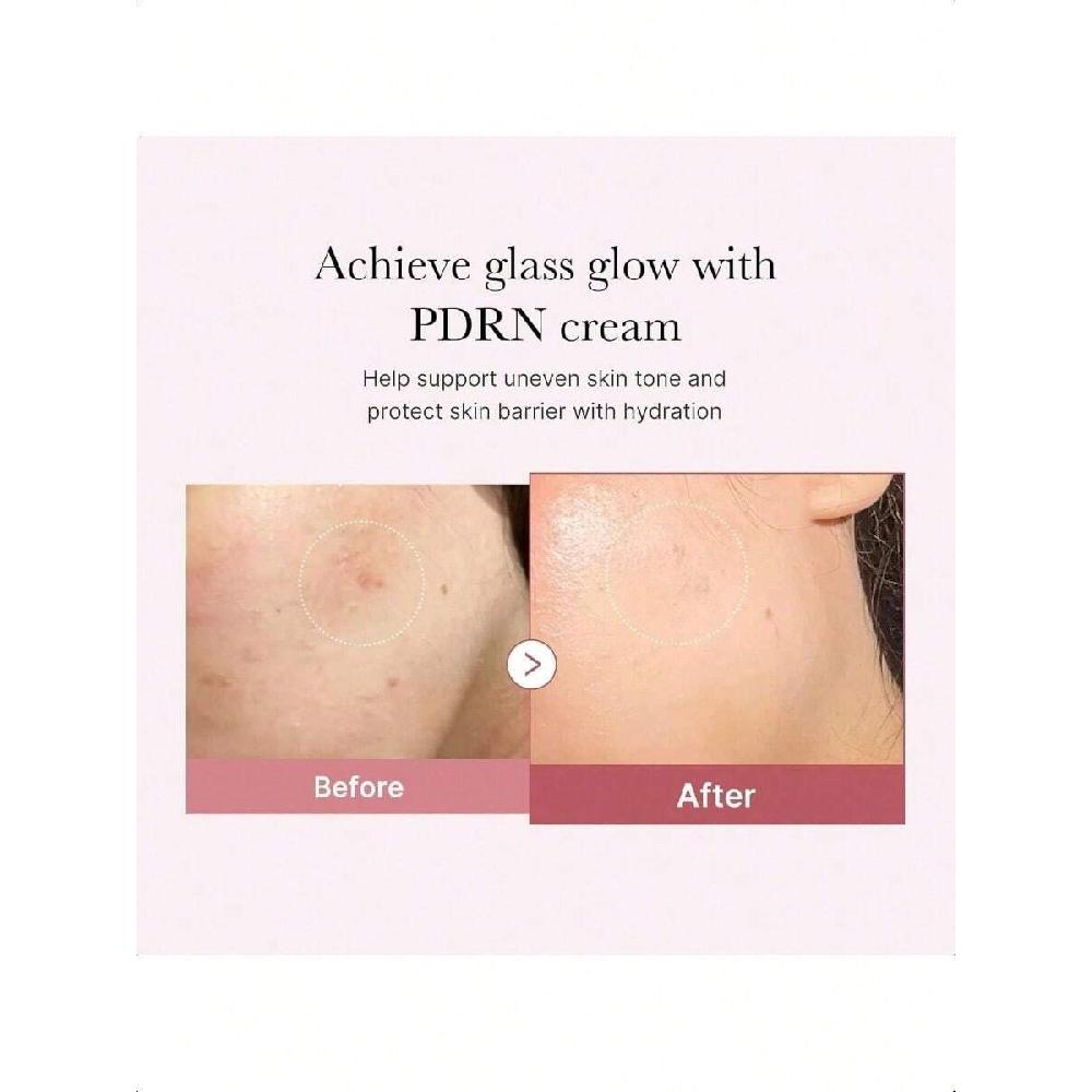 Medicube Pdrn Pink Hyaluronic Moisturizing Cream 50ml