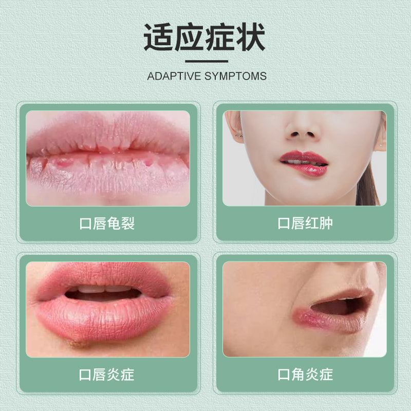 SHISEIDO Moilip Medicated Lip Cream 8g