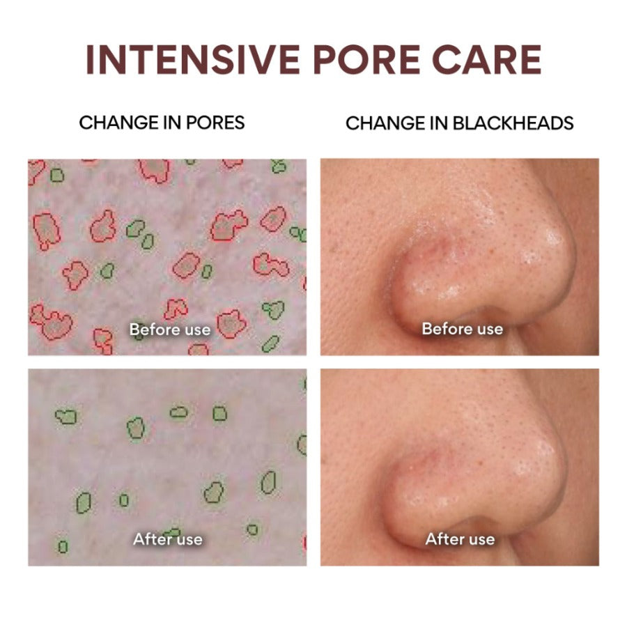 INNISFREE Super Volcanic Pore Clay Mask (100ml)