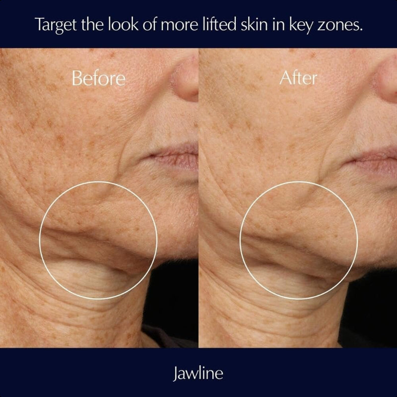 Estée Lauder Perfectionist Pro Rapid Firm + 100ML Lift Face Serum with Hexapeptides 8