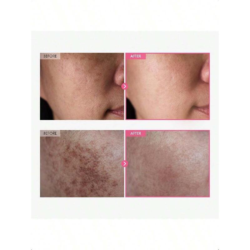 Tosowoong Arbutin 7% + Tranexamic Acid 4% Cream 50ml