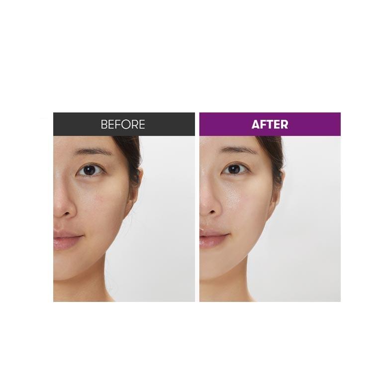 VT Reedle Shot Lifting Cream 50ml