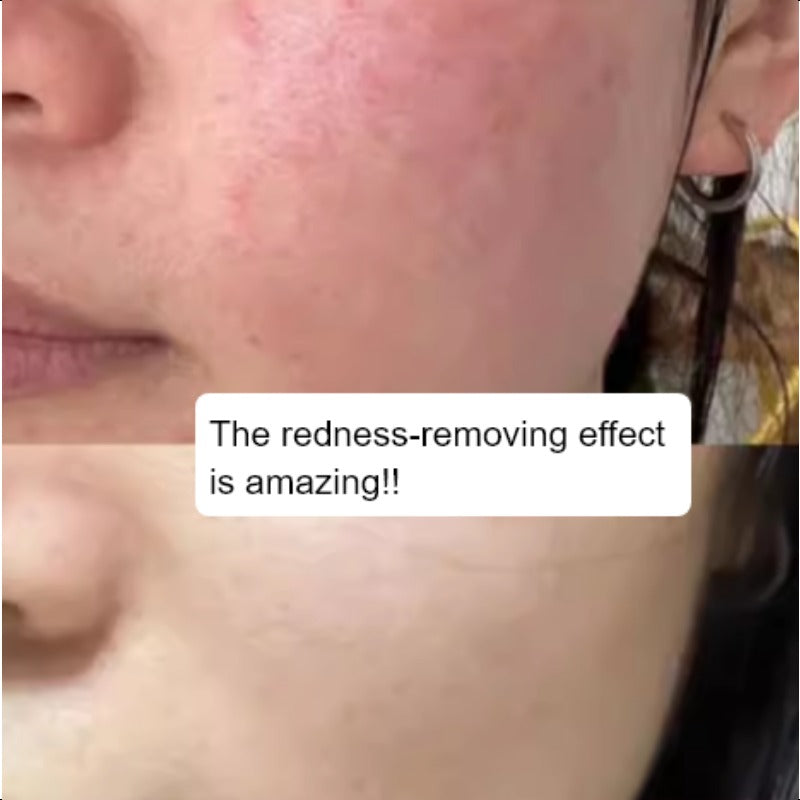 SKINCEUTICALS Phyto Corrective Essence 50ml Olive Leaf Cucumber Fruit Extract